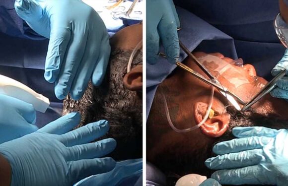 Tessica Brown Gets Gorilla Glue Out of Hair, Video of Surgery