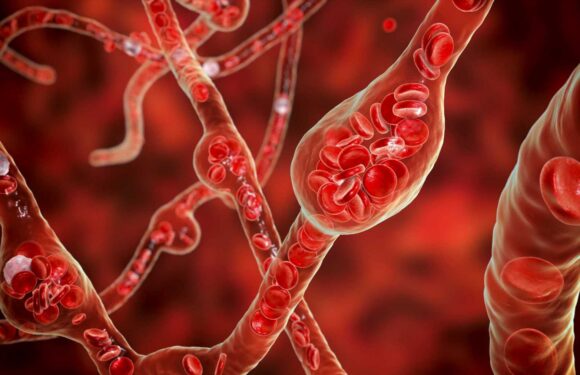 The 3 free and simple hacks to slash your risk of killer high blood pressure – without even moving | The Sun