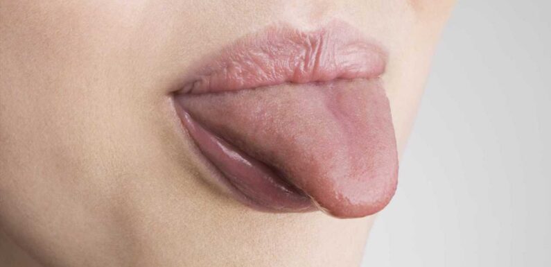 The 5 things your tongue can reveal about your health – from cancer to stroke risk | The Sun