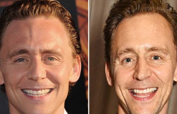 Tom Hiddleston — Good Genes Or Good Docs?!
