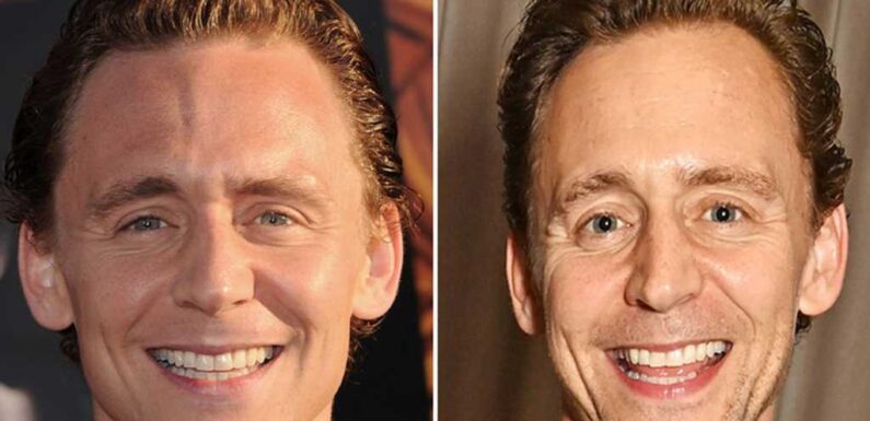 Tom Hiddleston — Good Genes Or Good Docs?!