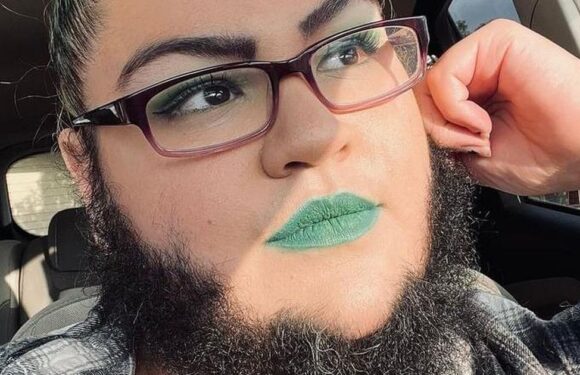 ‘Trolls say I look dirty and inhuman due to beard – but I won’t shave again’