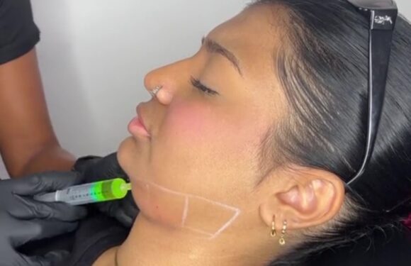 Woman blows people away as she shows the incredible before and afters of her double chin fat dissolving injections | The Sun