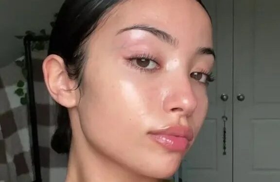 Woman shares shocking proof that the side you sleep on causes more acne, as she swears she washes her pillowcases | The Sun