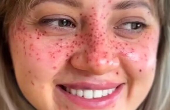 Women transform with freckle tattoos – but those bullied are baffled by ‘trend’