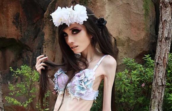 YouTuber Eugenia Cooney's Skinny and Frail Appearance Triggers 911 Calls from Fans
