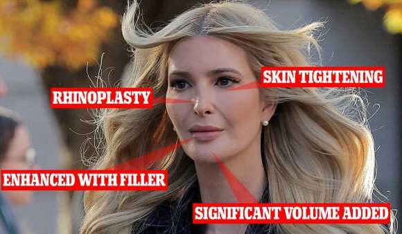 EXCL: Plastic surgeons reveal procedures Ivanka Trump may have had