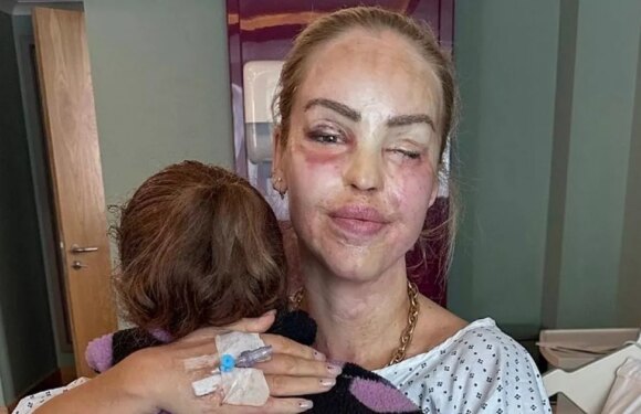 Katie Piper comforted by daughter in hospital after surgery to ‘save her eye’