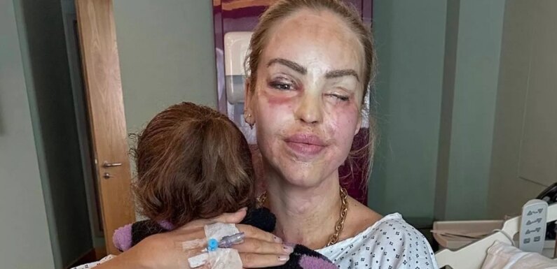 Katie Piper comforted by daughter in hospital after surgery to ‘save her eye’