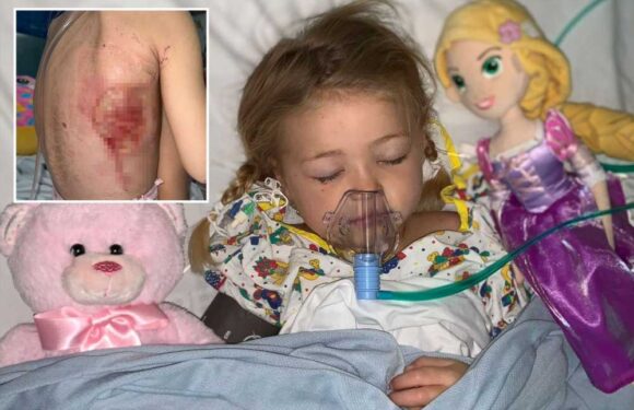 Mum issues urgent warning after chickenpox left little girl, 5, fighting for life with flesh-eating bug | The Sun