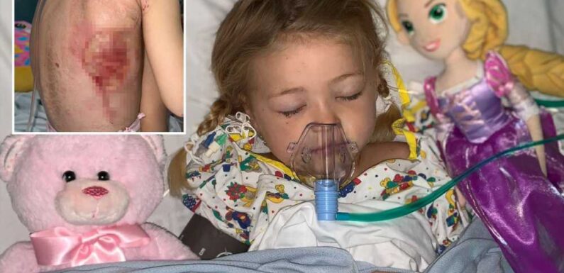 Mum issues urgent warning after chickenpox left little girl, 5, fighting for life with flesh-eating bug | The Sun