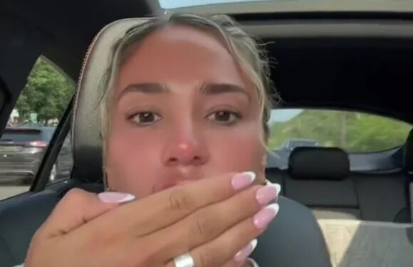 My lip filler migrated under my nose so I had them dissolved – it left me with a MOUSTACHE, I hated it | The Sun