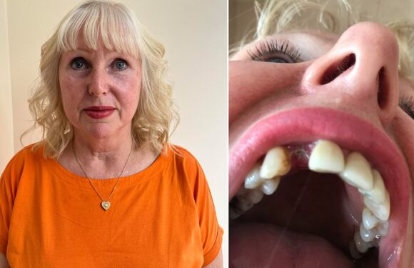 Nurse wins £10,000 payout after 'botched' dental work left her in pain