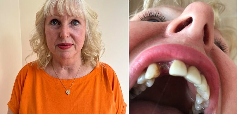 Nurse wins £10,000 payout after 'botched' dental work left her in pain