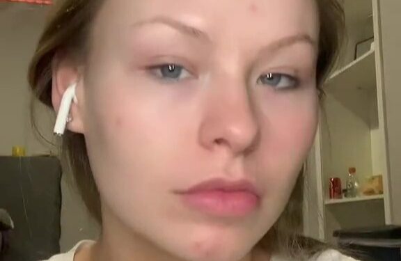 Woman is labelled a 'wizard' as she shows off her catfish transformation from plain Jane to Pamela Anderson lookalike | The Sun