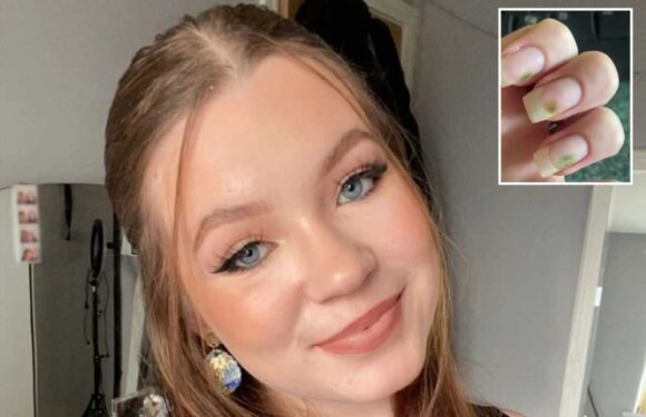 My nails turned GREEN and friends called them 'mouldy' – urgent warning for anyone getting acrylics this Christmas | The Sun